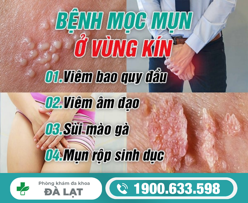 Hình ảnh minh họa
